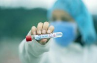 В Украине 3627 новых случаев коронавируса за сутки 