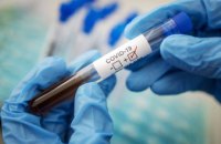 На Днепропетровщине подтвердили 209 новых случаев COVID-19