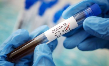 273 случая коронавируса обнаружили на Днепропетровщине за сутки