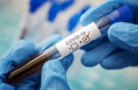 273 случая коронавируса обнаружили на Днепропетровщине за сутки