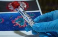 В Днепропетровской области зафиксировали 987 новых случаев коронавируса