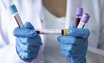 В Украине резко возросло количество инфицированных коронавирусом: за сутки почти 13 тысяч новых случаев 