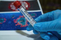 ​За добу в області два десятки нових випадків коронавірусу, ще 22 людини – одужали