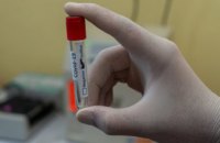 За сутки коронавирус обнаружили у 98 жителей Днепропетровщины
