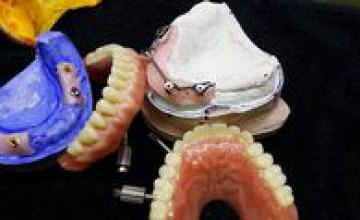 Medical Dental Group предлагает протезирование на 4-х имплантах на каждую челюсть при полном отсутствии зубов