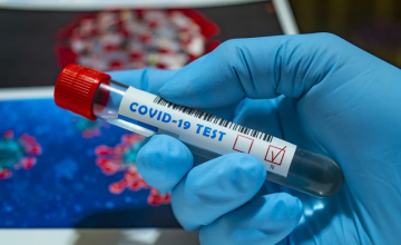 За сутки в Украине чуть более 2 тысяч новых случаев коронавируса 