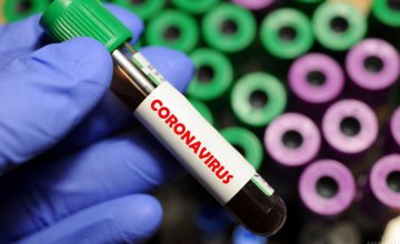 ﻿На Днепропетровщине обнаружили 12 новых случаев COVID-заболевания