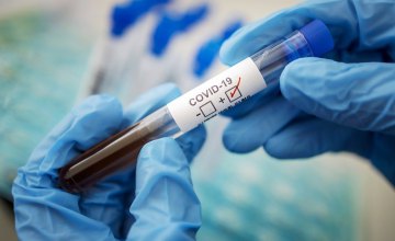 На Днепропетровщине зафиксировали 889 новых случаев коронавируса