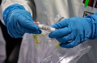 На Днепропетровщине обнаружили еще 7 случаев коронавирусной болезни