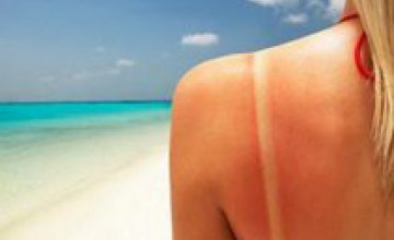 Солнечные ожоги на коже способствуют развитию раковых заболеваний, - врач 