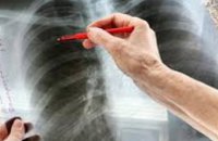 СЭС Днепропетровщины выявила 5 случаев туберкулеза у переселенцев с Донбасса