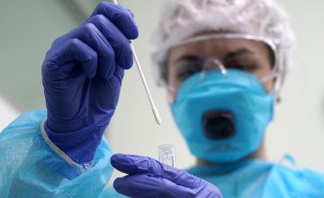 ​В Украине зафиксировано 33 тыс. 234 случая коронавирусной болезни 