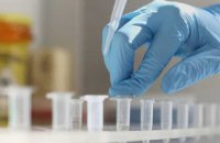 За сутки в Днепропетровской области обнаружили 6 новых случаев коронавируса