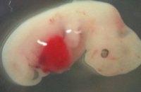 Ученые впервые создали химеру свиньи и человека