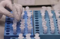 ​В Украине провели наименьшее количество тестов на коронавирус 