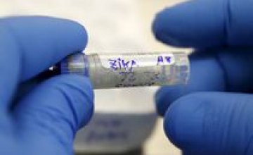 Тестирование вакцин от вируса Зика начнется через 1,5 года, - ВОЗ