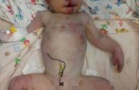 В одну из больниц Николаевской области подбросили избитого новорожденного мальчика (ФОТО)