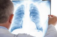 Международный институт научной медицины: как обезопасить себя от туберкулеза 