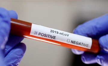 На Днепропетровщине обнаружили 11 новых случаев коронавируса