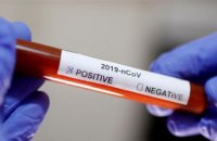 На Днепропетровщине обнаружили 11 новых случаев коронавируса
