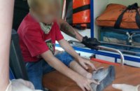 ​В Днепре 9-летний мальчик получил травму на территории заброшенного дома 