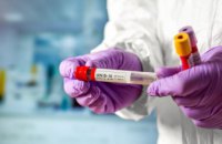 На Днепропетровщине обнаружили 17 новых случаев коронавируса