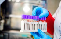 На Днепропетровщине за сутки выявили 187 новых случаев коронавируса 