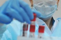 Еще 77 жителей Днепропетровщины выздоровели от коронавируса