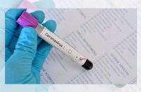 Вспышка коронавируса – 2020: меры безопасности, предпринимаемые на Днепропетровщине