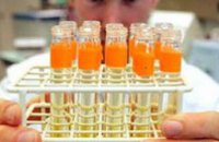 В Днепропетровской области «свиной» грипп лабораторно подтвержден у 76 человек
