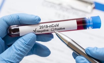 На Дніпропетровщині за добу виявили 213 випадків коронавірусу, ще 261 мешканець одужав