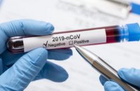 На Дніпропетровщині за добу виявили 213 випадків коронавірусу, ще 261 мешканець одужав