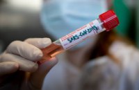 За сутки в Украине еще 14 174 человека заболели коронавирусом  