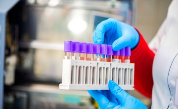 На Днепропетровщине лабораторно подтвердили 74 новых случаев коронавируса