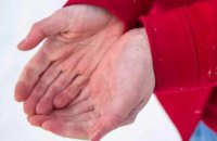 71-летний житель Днепропетровщины госпитализирован с обморожением пальцев | и || степени: обошлось без ампутации
