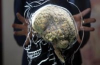 Американские ученые «вырастили» в лаборатории человеческий мозг