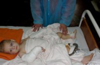 В Донецке годовалый малыш выпал из окна 4-этажа (ФОТО)