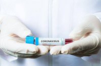 Ситуация с коронавирусом в Украине и Днепропетровской области (ОПЕРАТИВНАЯ ИНФОРМАЦИЯ НА 1 МАЯ)
