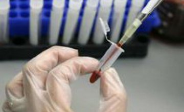 Американские ученые займутся созданием вакцины от вируса Зика