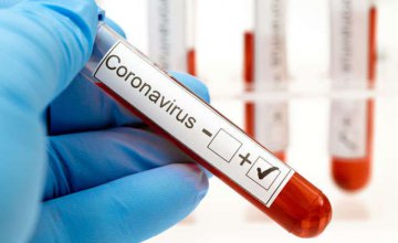 ​В Украине зафиксировано 17 858 случаев коронавирусной болезни COVID-19