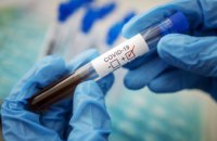 В Украине зафиксировано 16023 случая коронавирусной болезни COVID-19