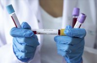 На Днепропетровщине зафиксировали 556 новых случаев коронавируса
