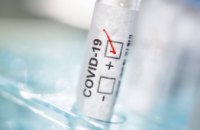 В Украине зафиксировали резкий спад коронавируса